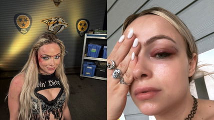 Backstage update on Liv Morgan’s health status after being busted open on Raw