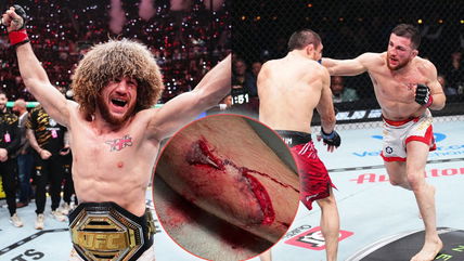 “He’s actually insane” – Merab Dvalishvili’s brutal injury that was hidden from California commission leaves fans in shock