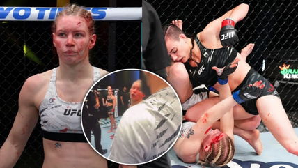 UFC fighter Viktoriia Dudakova slaps coach leaving fans surprised: “Should’ve punched her back”