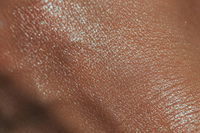 Scientists Have Created A Recipe For Human Skin, Which Could Help With Burn Victims And Scarring