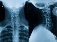 This New Development Could Help Repair Spinal Cord Injuries