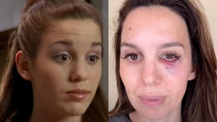 Former Disney Star Christy Romano Miraculously Survives Being Shot In The Face – ‘Be Grateful For Every Day’