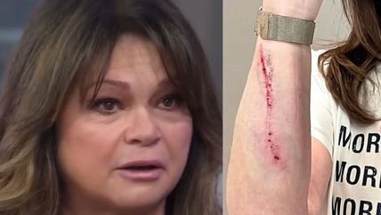 Valerie Bertinelli, 64, Suffers Brutal Injury After Falling While Working On ‘New Project’