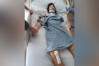 Flagler Estates boy badly injured in hit and run is now conscious and speaking