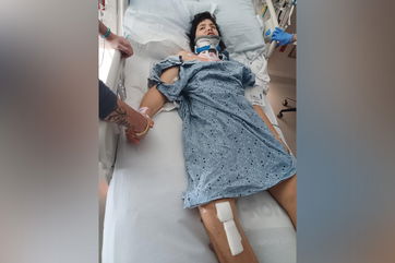 Flagler Estates boy badly injured in hit and run is now conscious and speaking